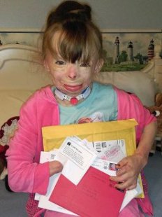 8-Year-Old Burn Victim Who Lost Family in Fire Wishes for Christmas Cards